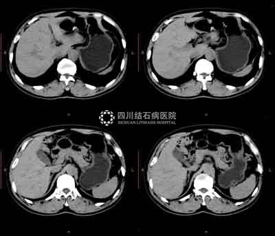 襄阳治疗人流时间哪里好