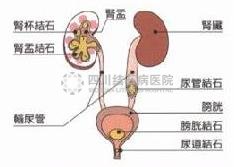 人流准备症状