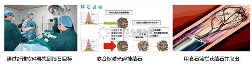 手术过程